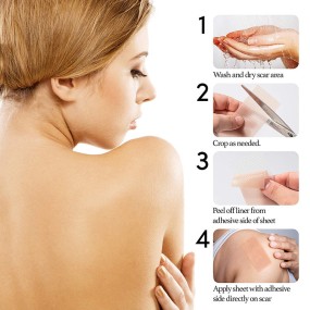 Silicone Gel Patch Supplier - Elastic Bandage C-Section