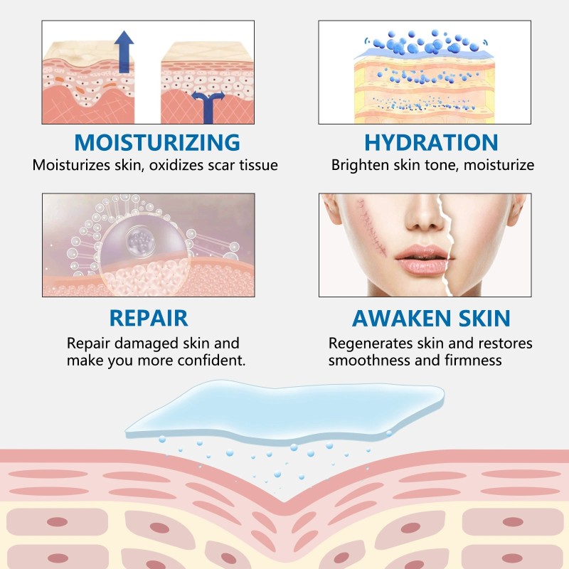 Medical Scar Sheets Manufacturer - Waterproof Hydrates Self-Adhesive