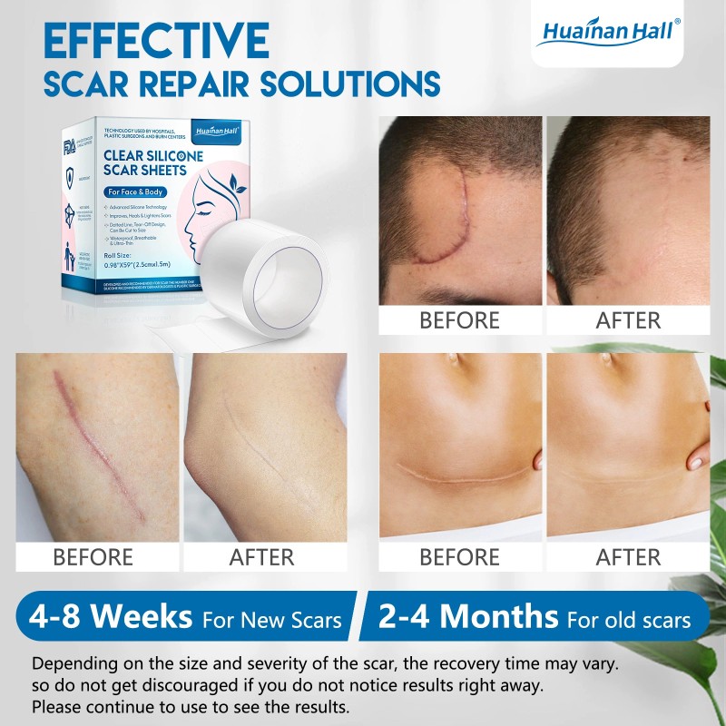 Medical Scar Sheets Manufacturer - Waterproof Hydrates Self-Adhesive