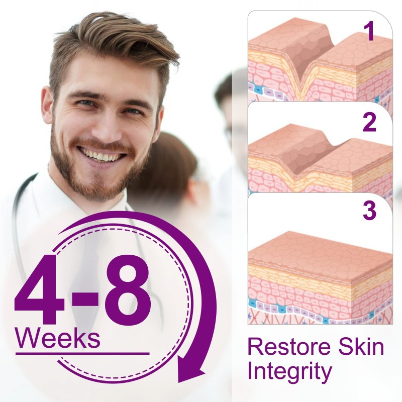 Silicone Scar Sheets Factory - Facial Belly Leg Removal