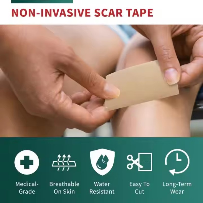 Silicone Scar Patch Supplier - Waterproof Burn Hyperplasia