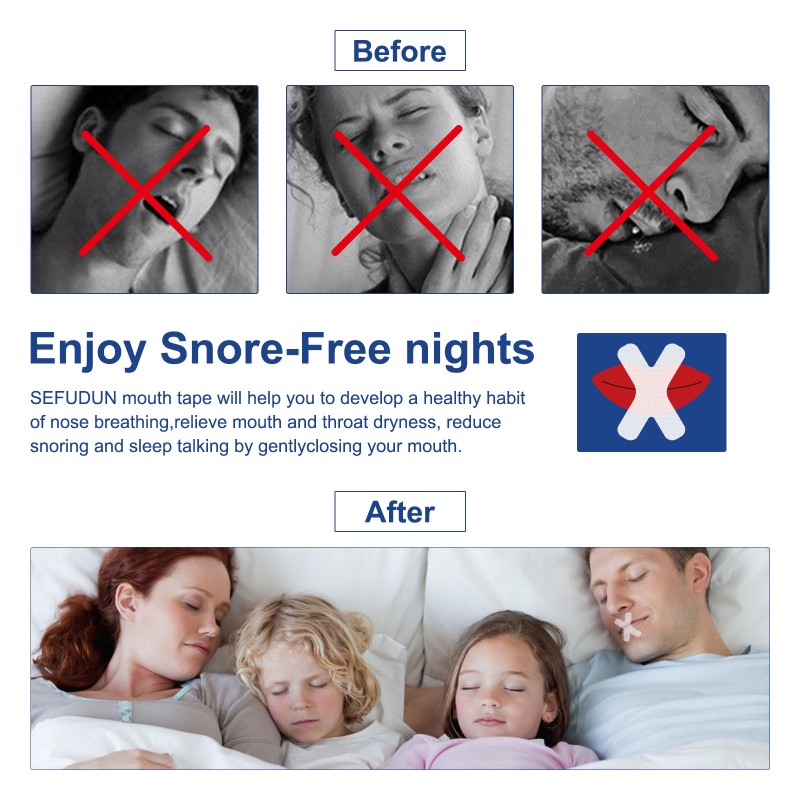 Anti-Snoring Sticker Factory - Breathing Correction Night Use