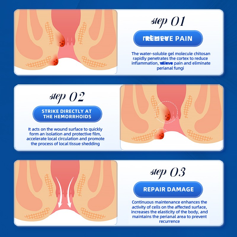 Hemorrhoids Ointment Supplier - Natural Anal Fissure Relief