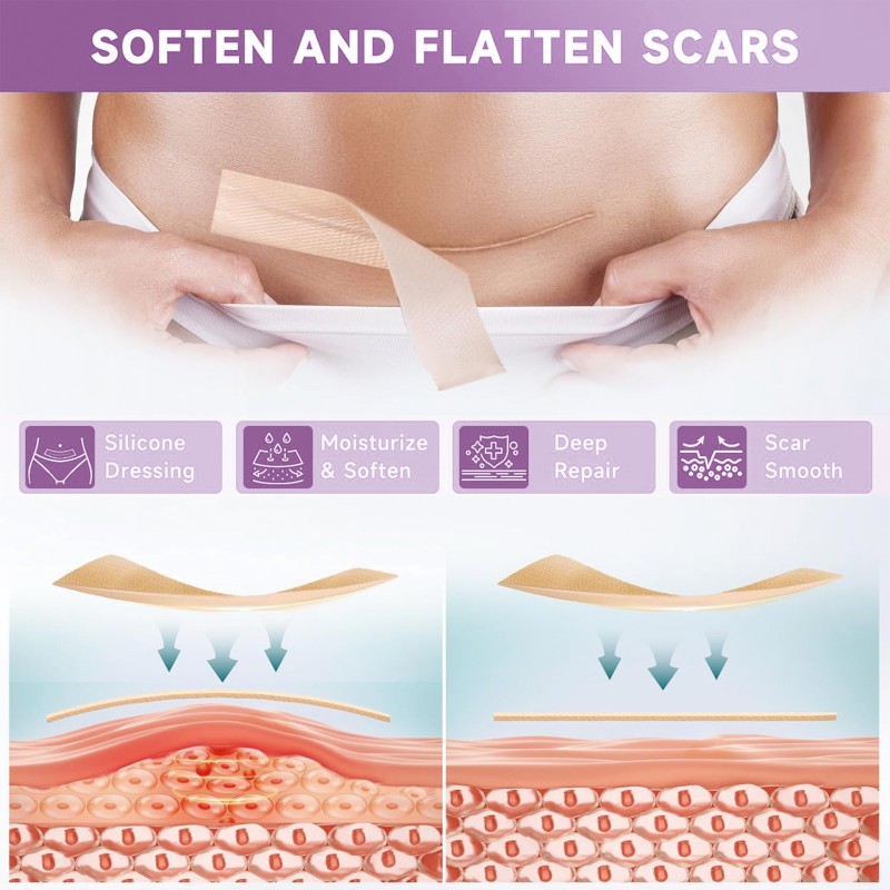 Self-Adhesive Bandage Manufacturer - Reusable Scar Removal