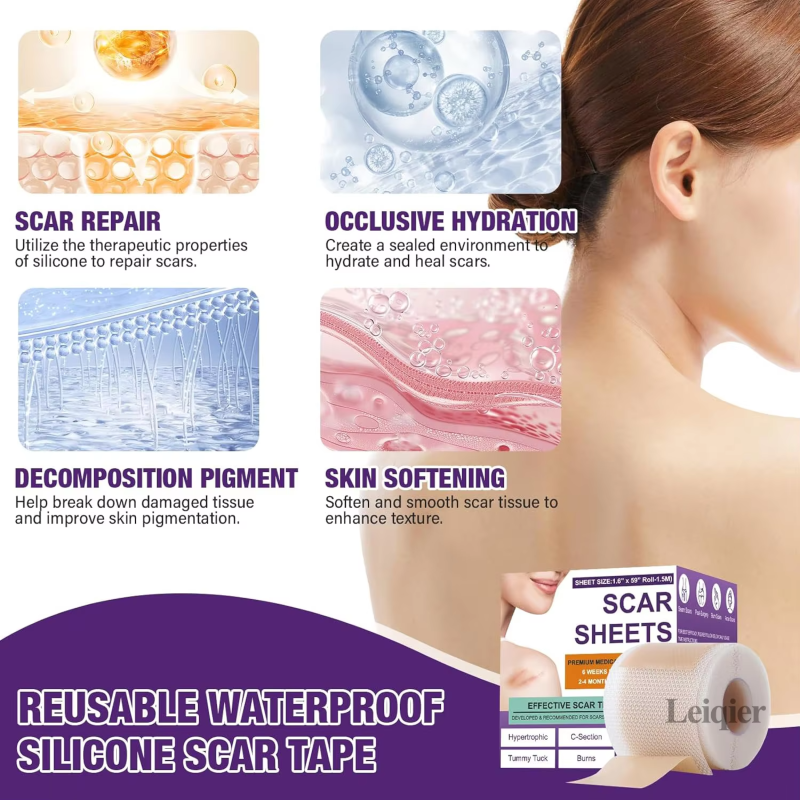 Gel Scar Dressing Supplier - Wound Repair Hypoallergenic