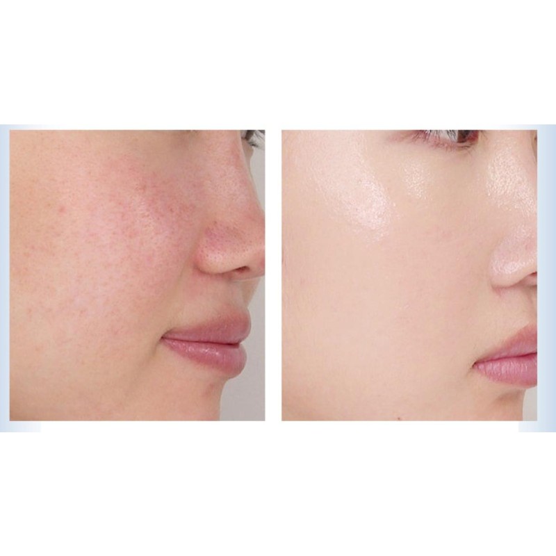 Inositol Powder Factory - 99% Vitamin B8 Mood Support