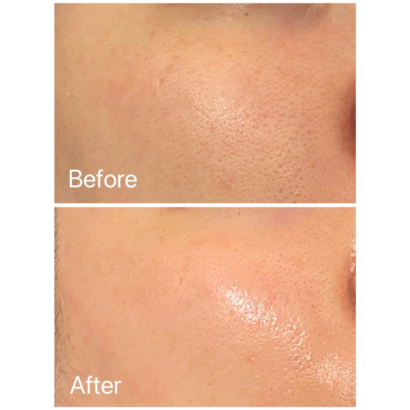 Hyaluronic Acid Supplier - Plant Extract Skincare Care