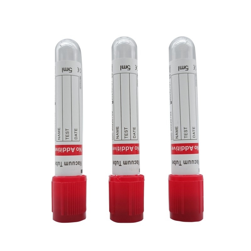 Non-Vacuum Blood Tube with Gel Separator & Clot Activator (PP 1-4ml, 13 * 75mm)