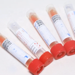 PP Material Lastic Tube for Virus Transport Medium Swab and Viral Transport Medium Set