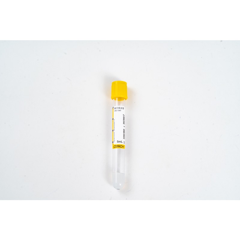 Non-Vacuum Blood Glucose Tube with Sodium Fluoride/Potassium Oxalate (PP 1-4ml, 13*75mm)