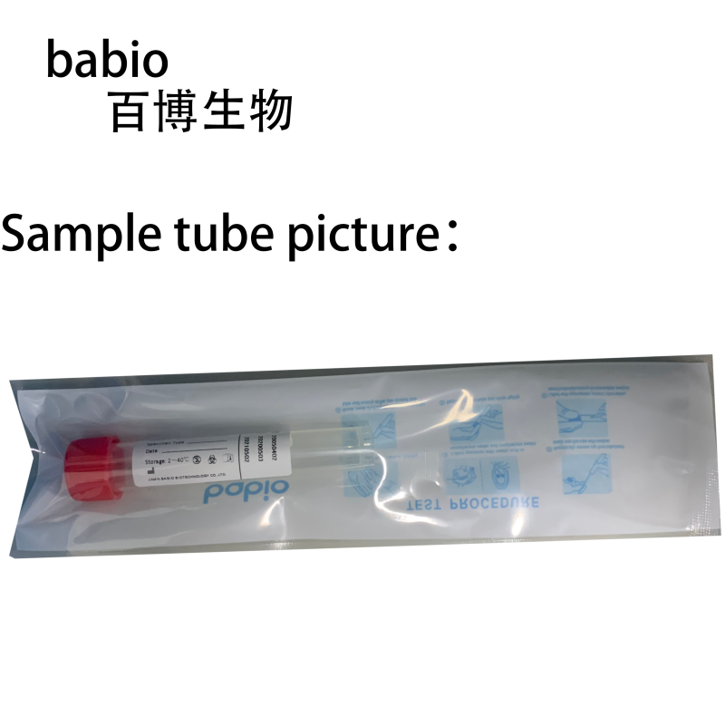 Disposable Transport Culture Medium VTM's Sampling Collection Kits