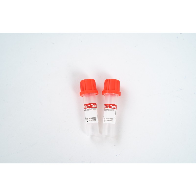 Non-Vacuum Blood Glucose Tube with Sodium Fluoride/Potassium Oxalate (PP 1-4ml, 13*75mm)