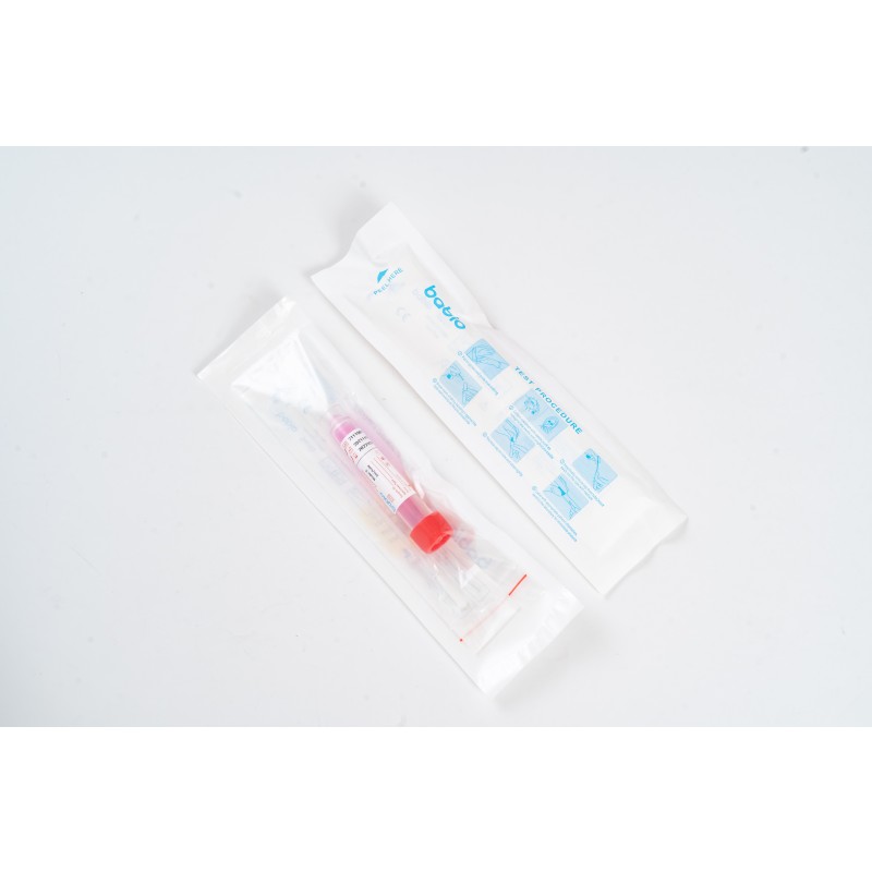 High Quality Saline Preservation Solution Sampling Tube