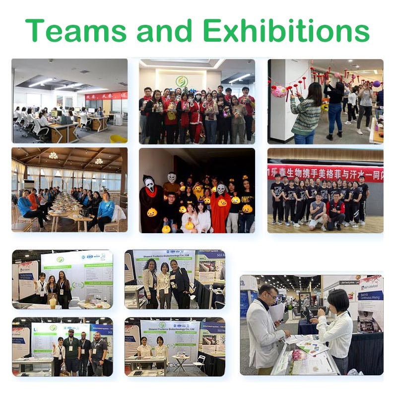 Manufacturer Wholesale Bifidobacterium Breve Health Supplement Probiotics Bifidobacterium Breve