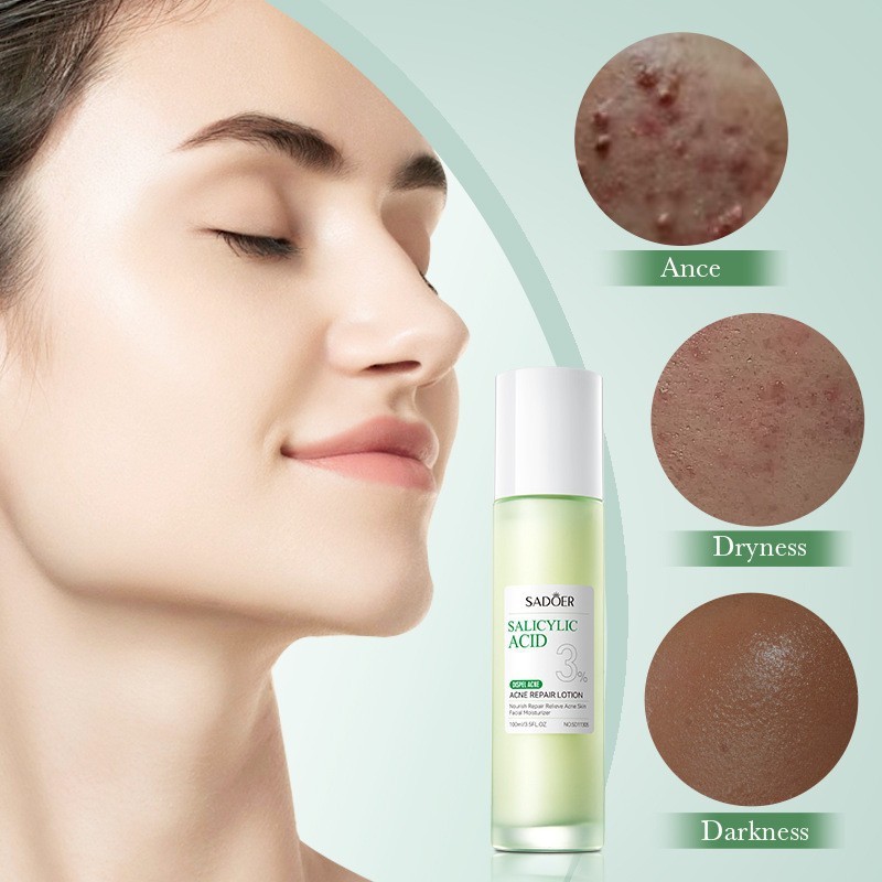 Salicylic Acid Acne Serum Anti-acne Serum  Acne Toner Skincare Line Face Cream