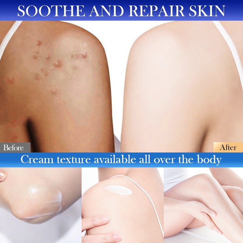 Autumn Winter Moisturizing Type III Collagen Body Lotion