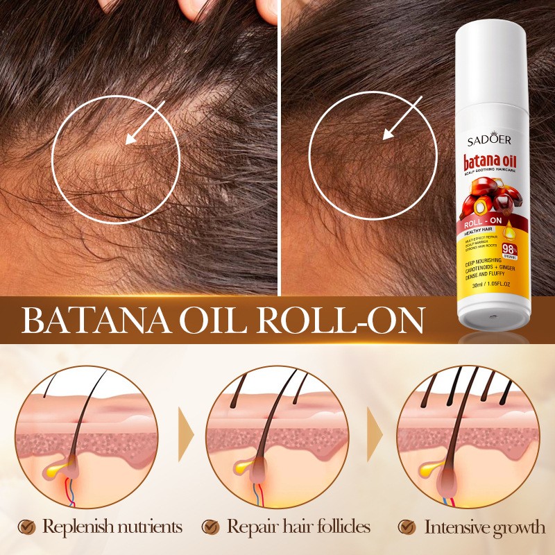 Batana Scalp Soothing Hair Conditioner Moisturizes and Nourishes Hair Care Balls