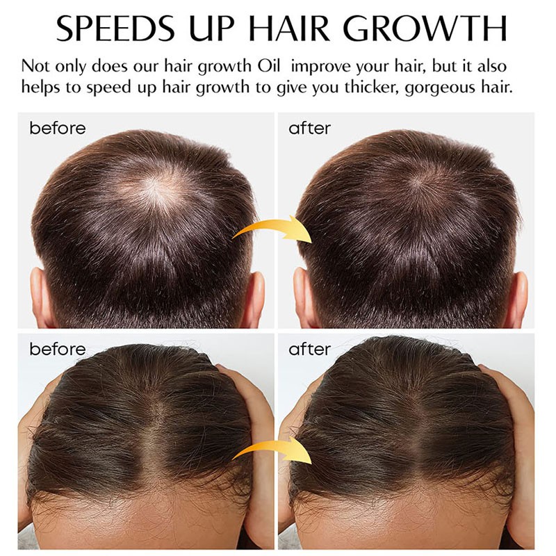 Fashion High End Female and Male Hair Growth Regrowth Oil Hair Grow Serum