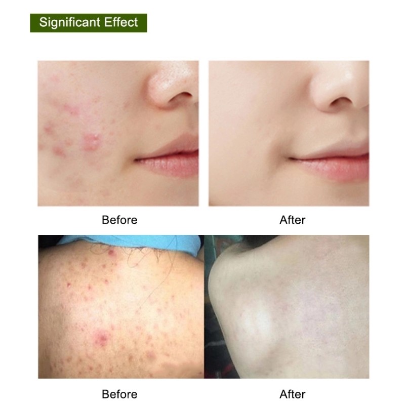 Best Quality Handmade Papaya Brightening Skin Lightening Bathing Toilet Whitening Turmeric Kojic Acid Soap