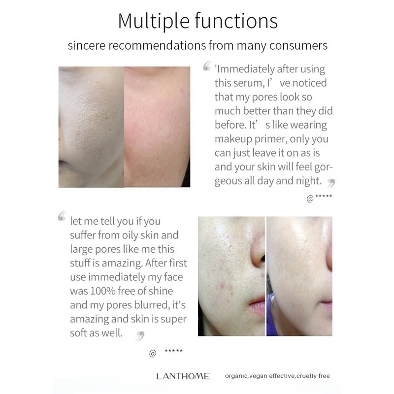 Customized Private Label 10ml Blackhead Removal Tightens Skin Pore Shrinking Serum for Skin Care