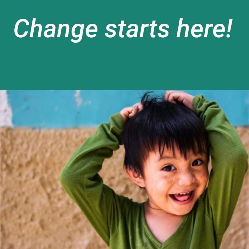 OEM Pure Vitamin E 1000 IU 240 Softgels Oil Pills Antioxidant Supplements for Skin Face Immune Health