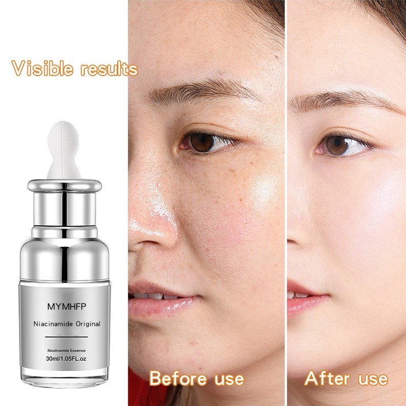 Niacinamide Beauty Serum for Personal Care softly protecting your face