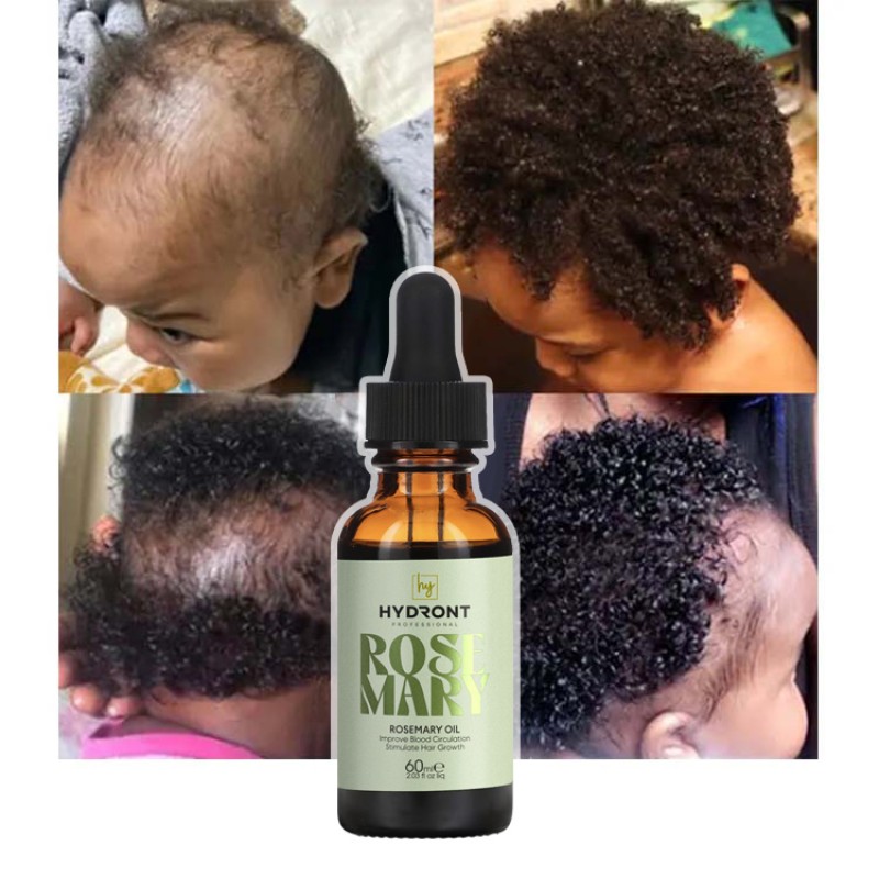 Wholesale Organic and 100% Natural Formula Herbal Rosemary Mint Scalp & Hair Strengthening Oil Hair Growth Oil