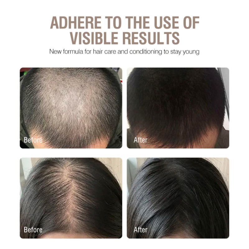 Private Label 100ML Natural Formula Anti Hair Loss Serum Hair Growth Spray Repair Hair Follicles