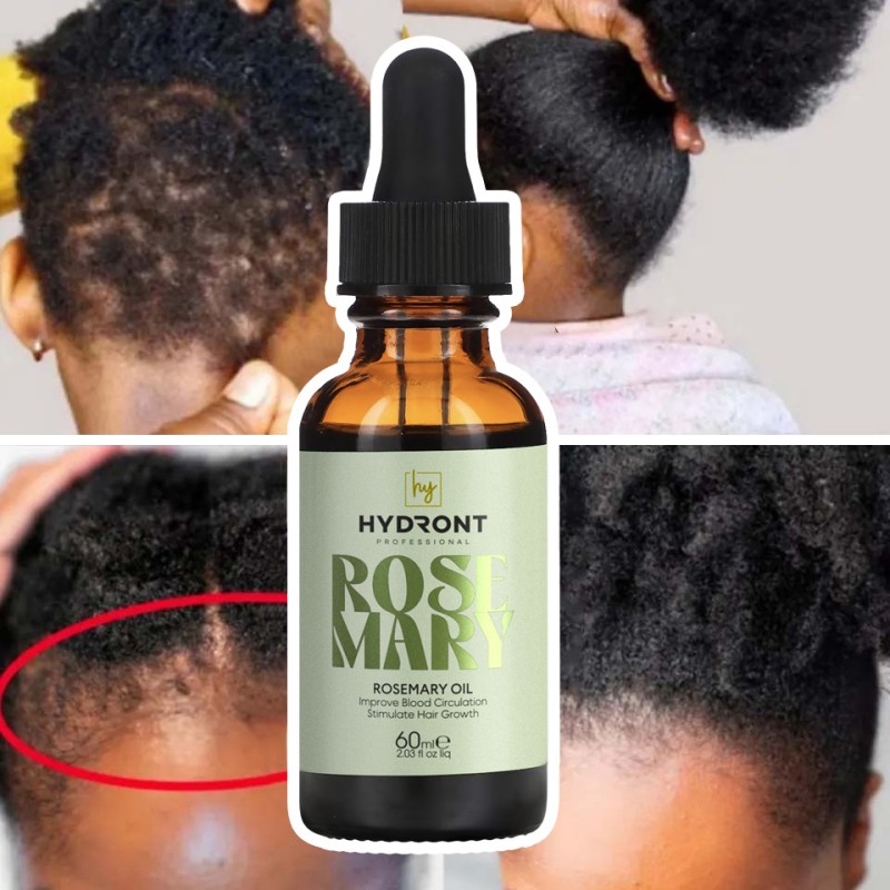 Private Label 100% Pure Organic Natural Hair Growth Oil Fast Growth Hair Rosemary Oil Hair Loss Treatment