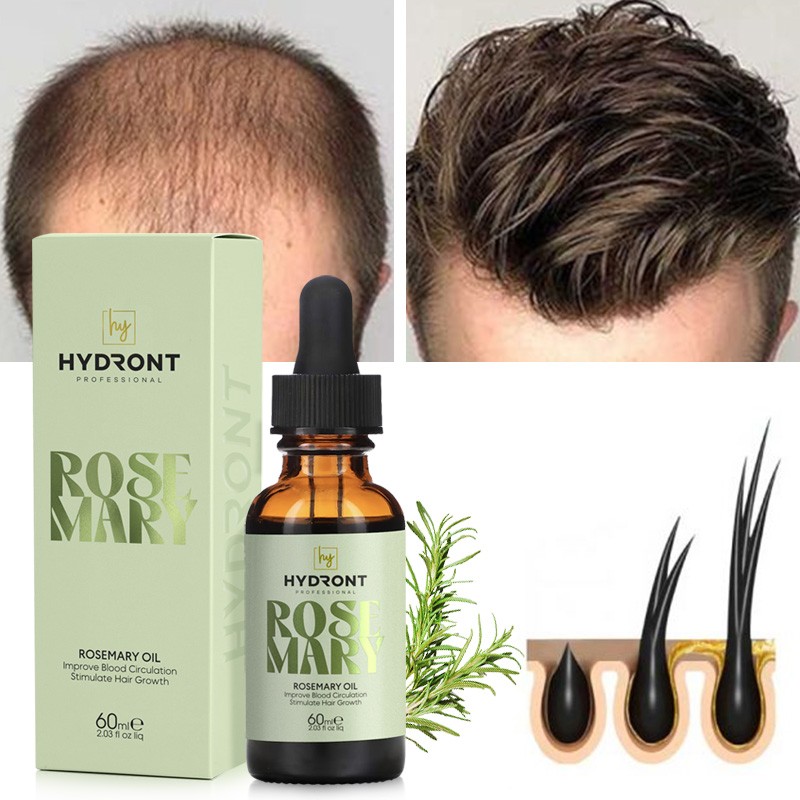 Wholesale Organic and 100% Natural Formula Herbal Rosemary Mint Scalp & Hair Strengthening Oil Hair Growth Oil