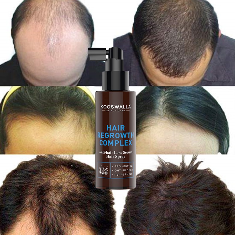 Customized Wholesale Private Label Organic and Natural Anti Hair Loss Hair Treatment Hair Growth Spray
