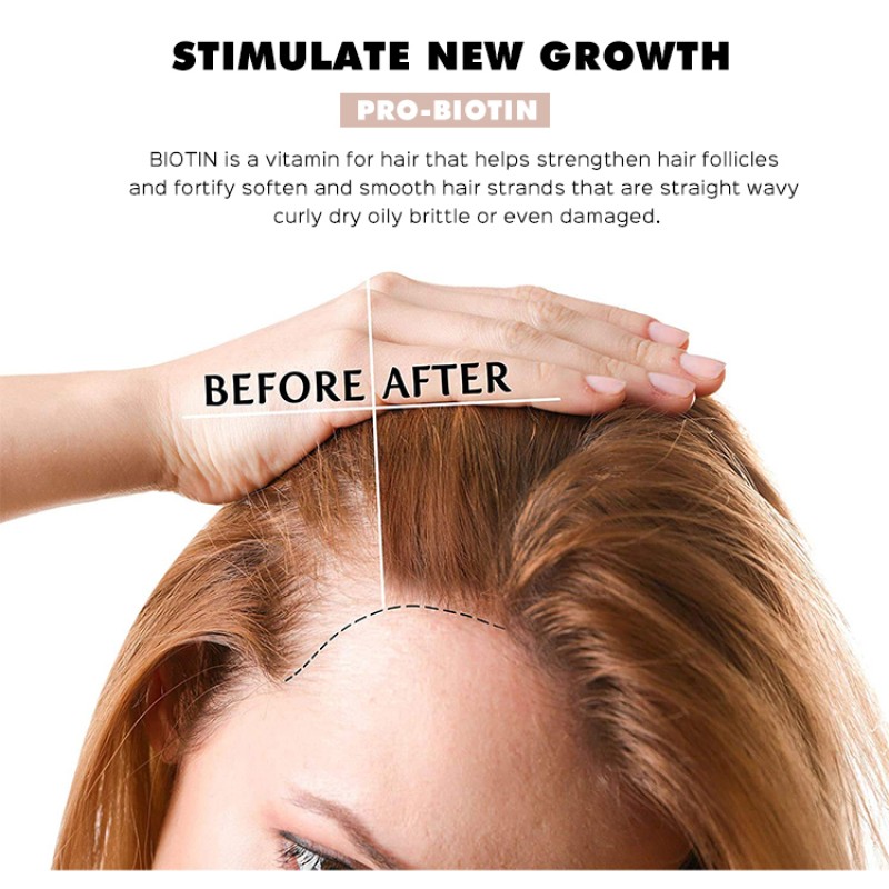 Private Label 100ML Natural Formula Anti Hair Loss Serum Hair Growth Spray Repair Hair Follicles