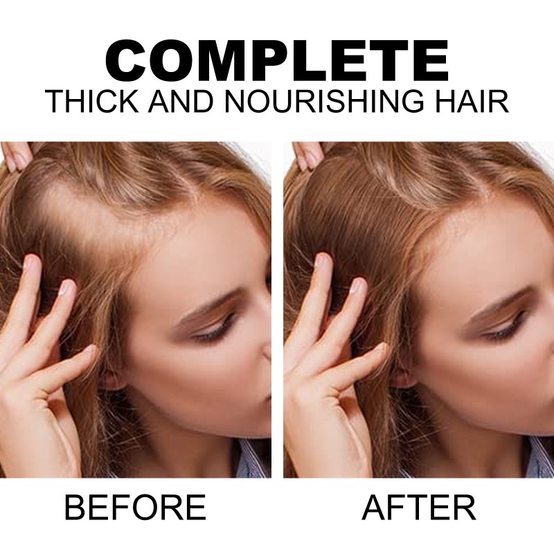 Hair Growth Spray Manufacturer - Black Rice Repair