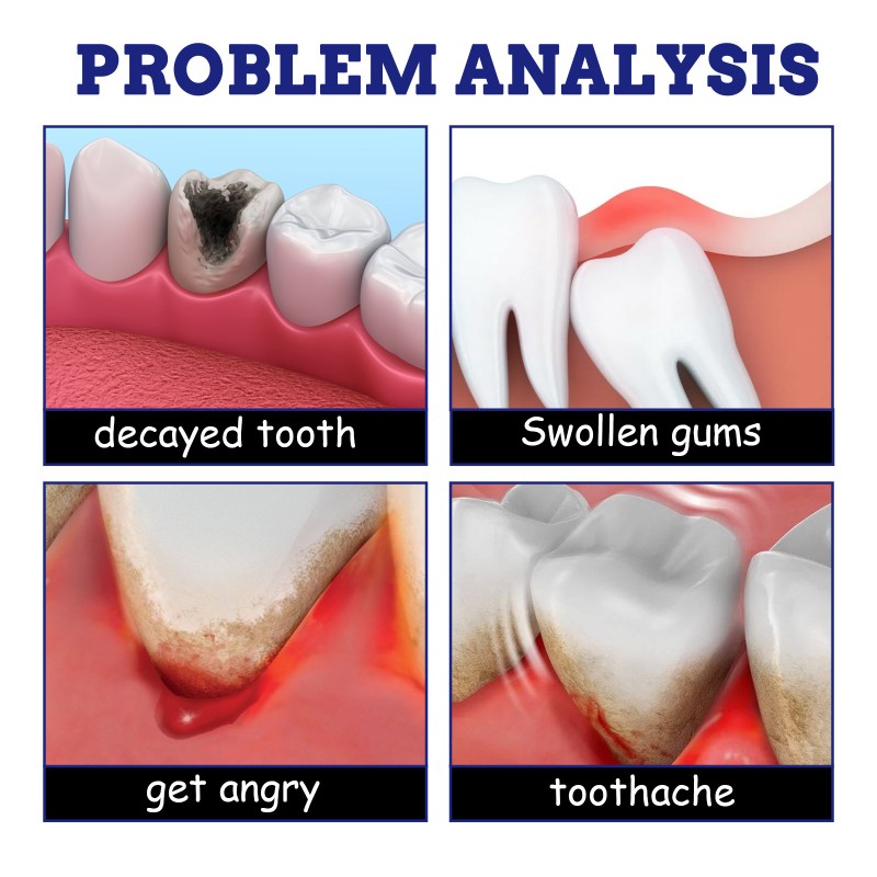 Toothache Spray Factory - Chinese Medicine