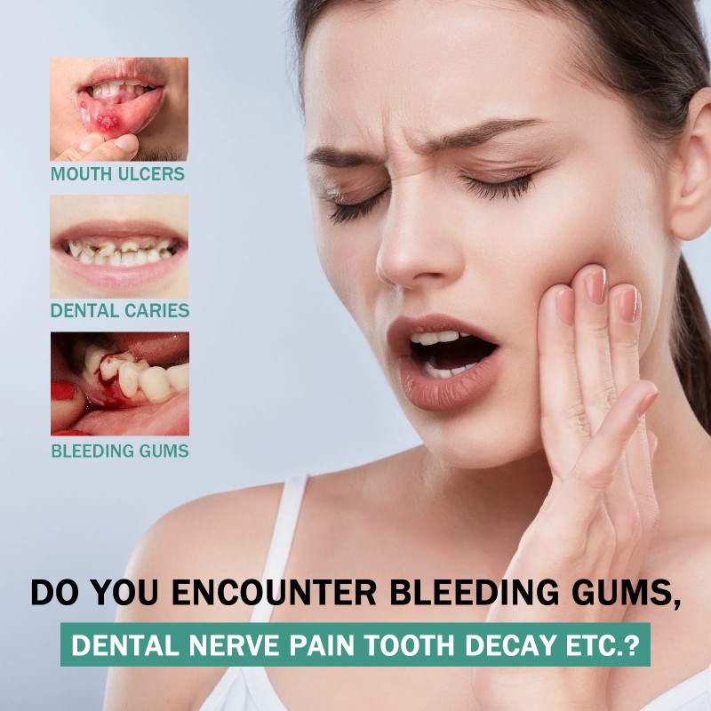 Oral Spray Manufacturer - Aphthous Sores Relief