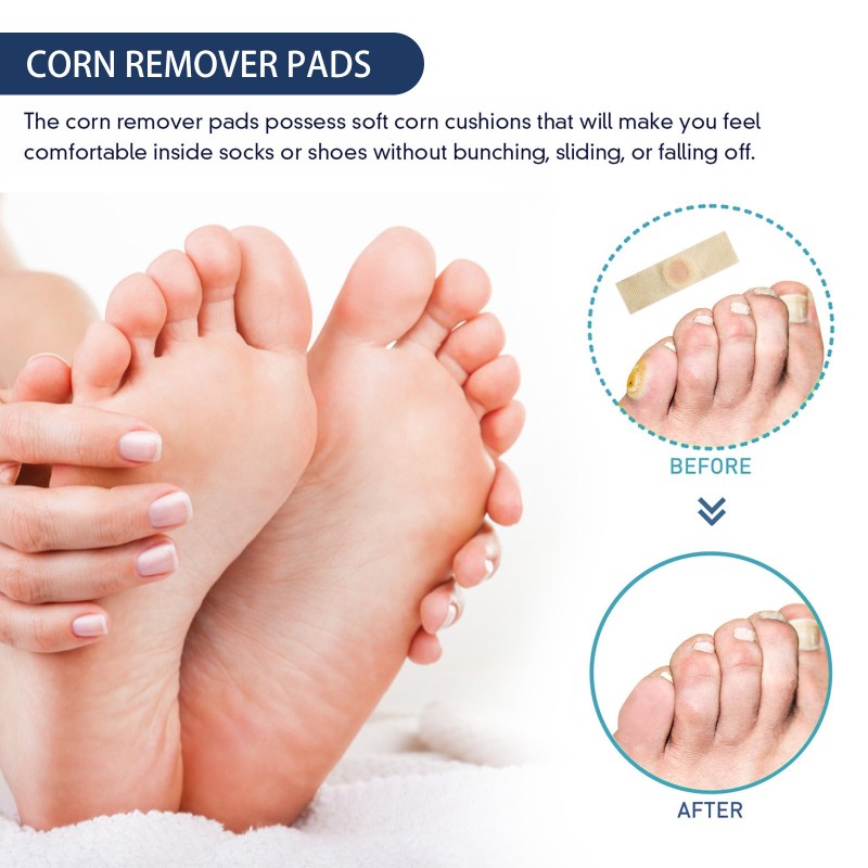 Corn Removal Supplier - Foot Pain Relief Paste