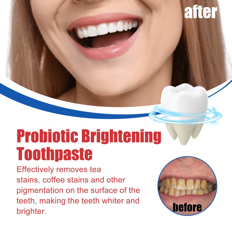 Toothpaste Manufacturer - Probiotic Whitening