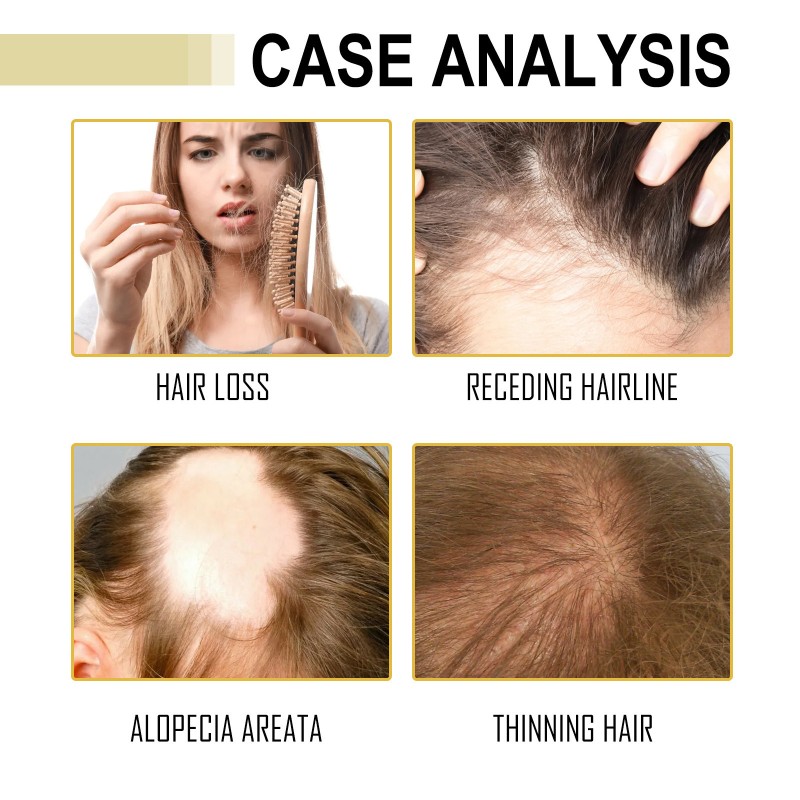 Scalp Oil Supplier - Rosemary Mint Biotin