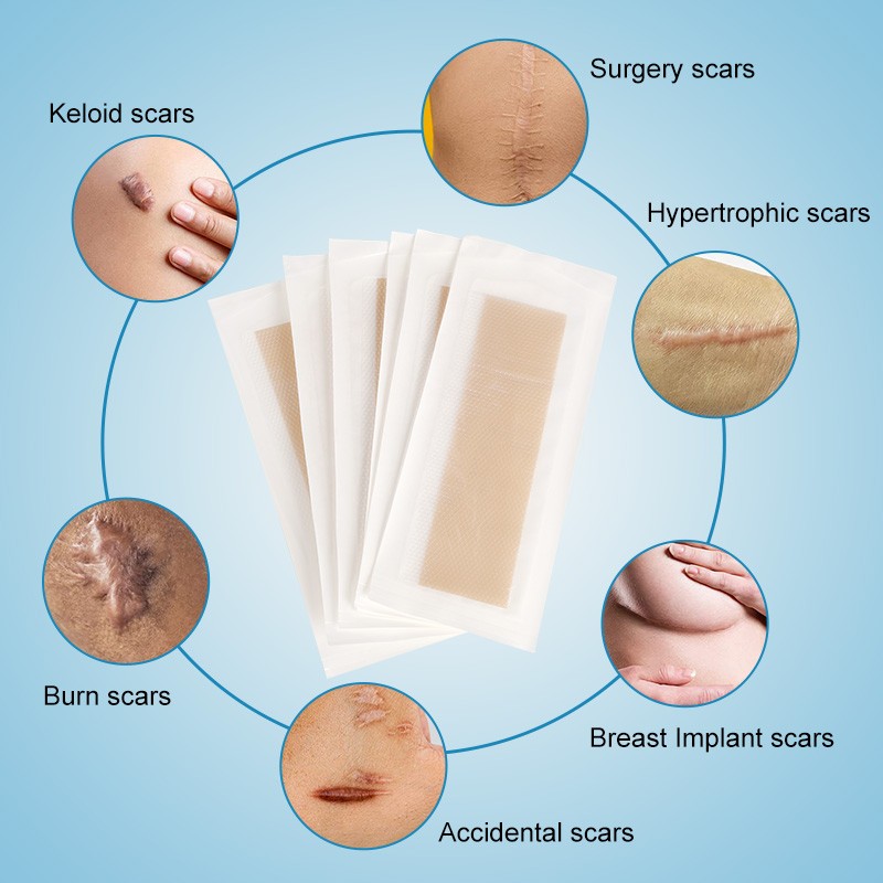 Silicone Scar Patch Factory - Gel Removal Economic