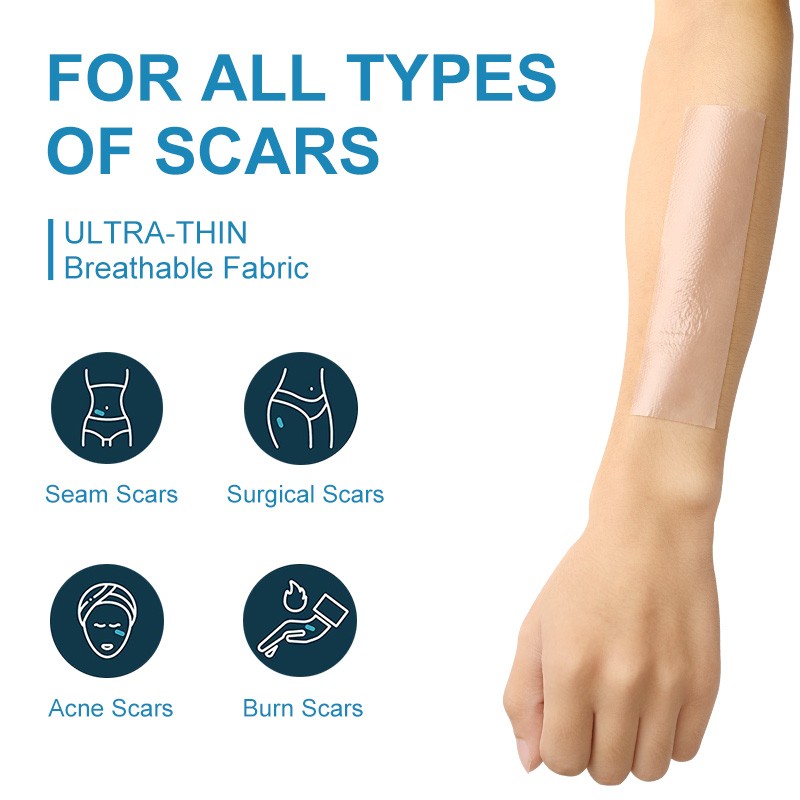 Silicone Therapy Tape Factory - Reusable Scar Removal