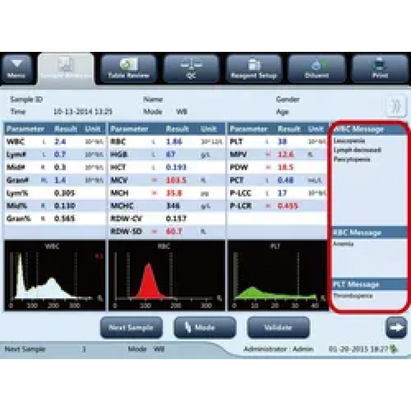 Hematology Analyzer Supplier - Mindray BC-20 Laboratory
