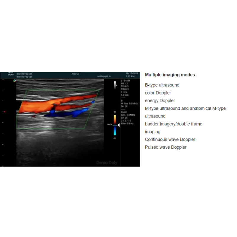 Veterinary Ultrasound Scanner Supplier - Pregnancy Test Dog