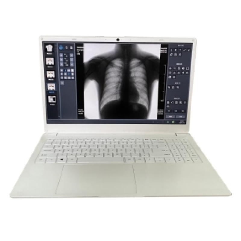 Portable X-ray Machine Factory - Digital 5KW Veterinary