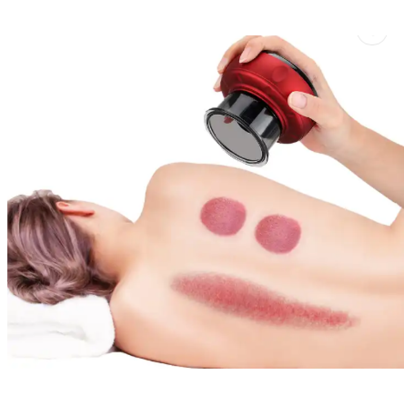 Electronic Cupping Set Supplier - Vacuum Intelligent Breathing