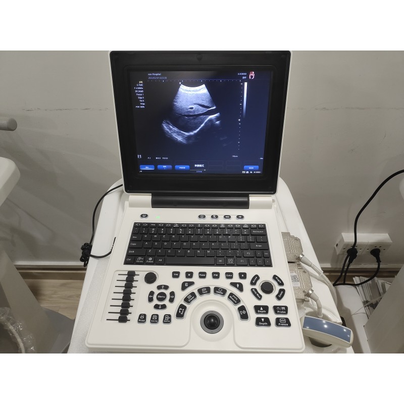 Color Doppler Ultrasound Supplier - C2 Laptop Portable