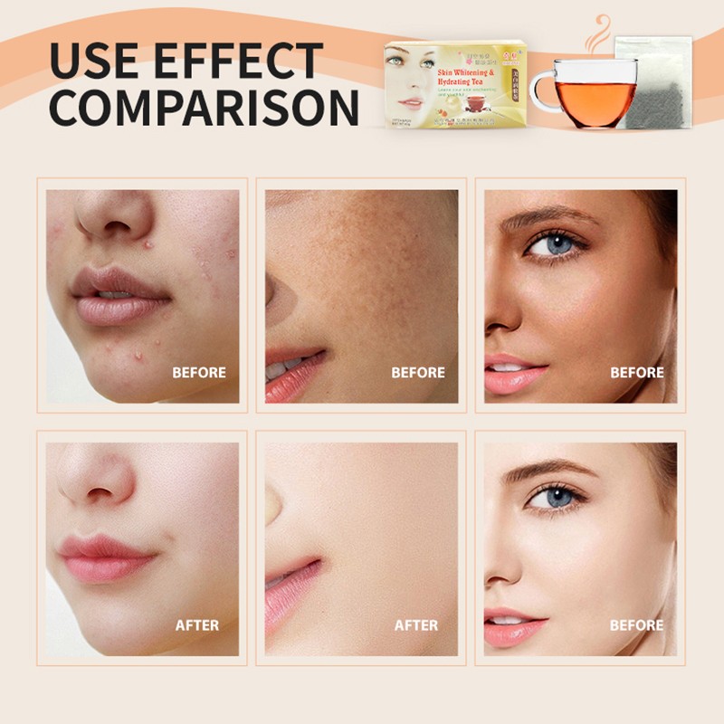 Antioxidant Tea Supplier - Green Tea Rooibos