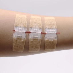 Butterfly Kit Supplier - Zip Stitch Wound Closure