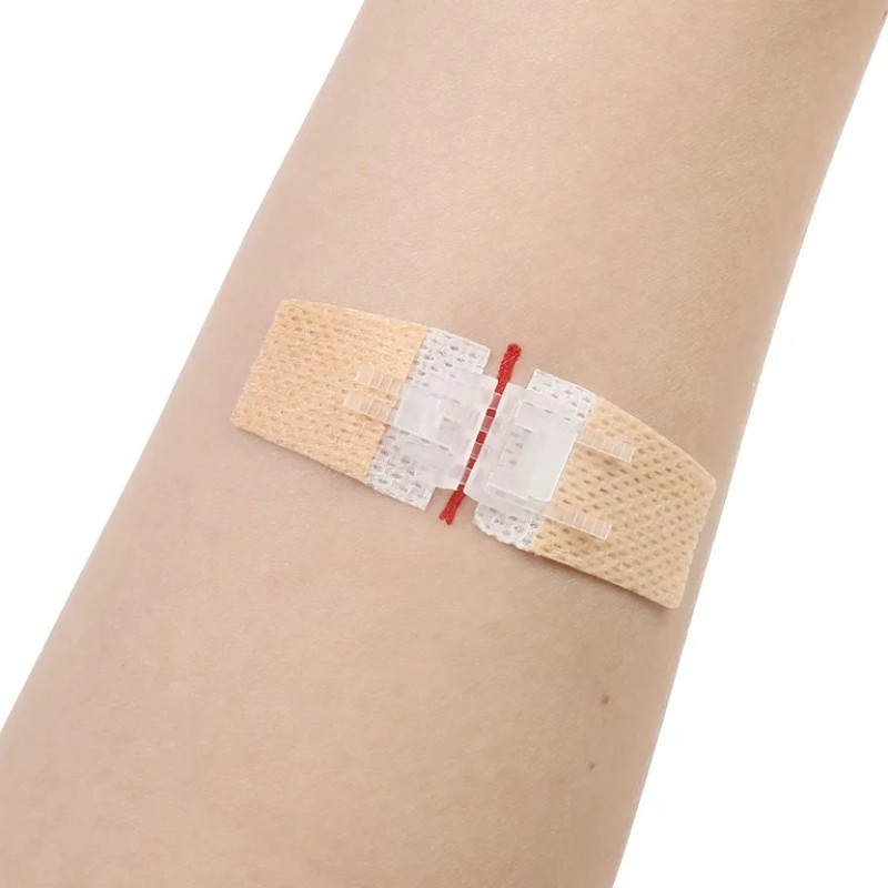 Wound Closure Strips Supplier - Butterfly Bands Laceration