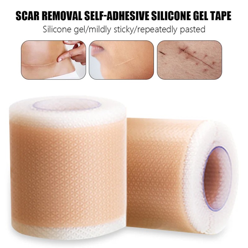 Silicone Scar Sheets Factory - Professional Keloid Treatment