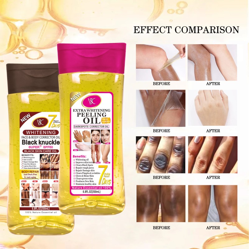 Wholesale Whitening Body Oil Reduce Spot Brightening Koji Acid Oil Face Body Gel Massage Oil 200ml